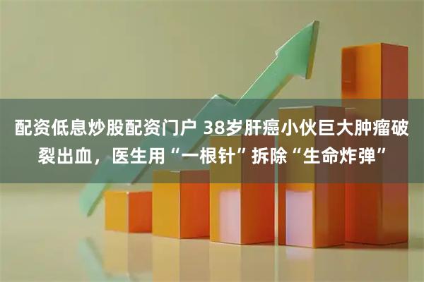 配资低息炒股配资门户 38岁肝癌小伙巨大肿瘤破裂出血，医生用“一根针”拆除“生命炸弹”